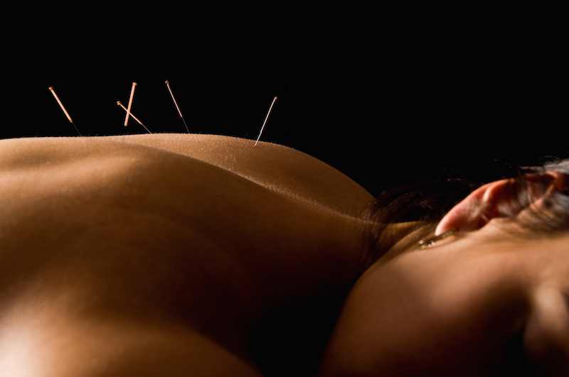 Acupuncture clinic in Spearwood WA